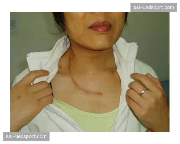 减重危机再现:一名选手因脱水过重住院,赛前称重环节引业界讨论